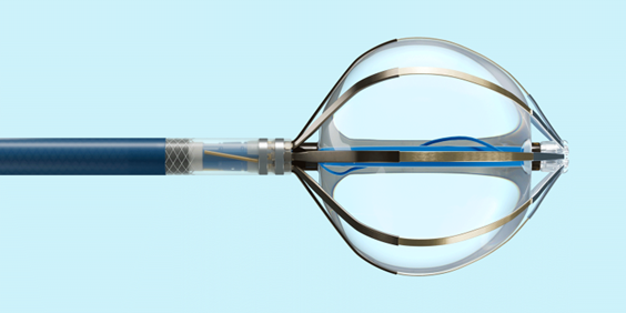 El sistema de ablación por campo pulsado de Abbott, disponible en España para tratar las arritmias cardíacas