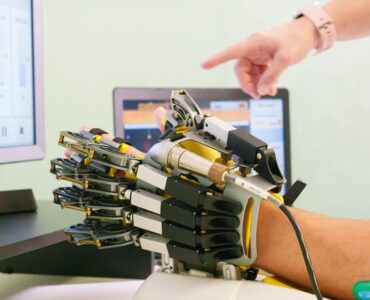 «La neurorrehabilitación permite, en momentos concretos de la enfermedad del Parkinson, mejorar limitaciones motoras, de coordinación o dolor, lo que se traduce en meses o años de vida con mayor calidad», Dr. Alejandro Durán